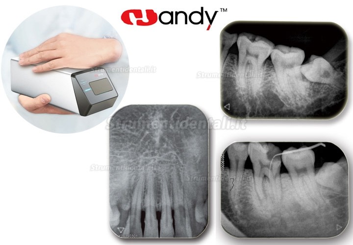 Handy HDS-500 scanner psp dentale scanner ai fosfori